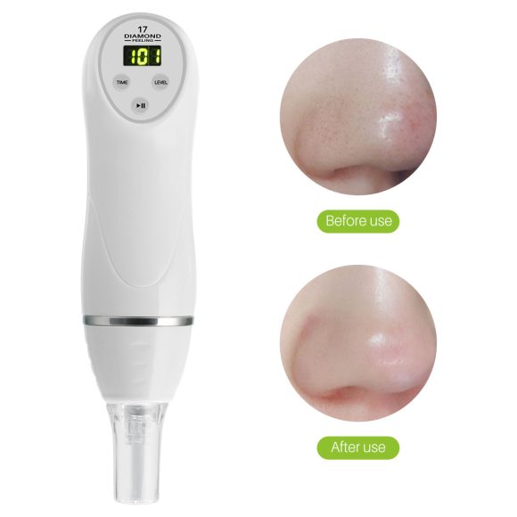 Electric pore suction and acne removing device beauty cleaner - Image 8