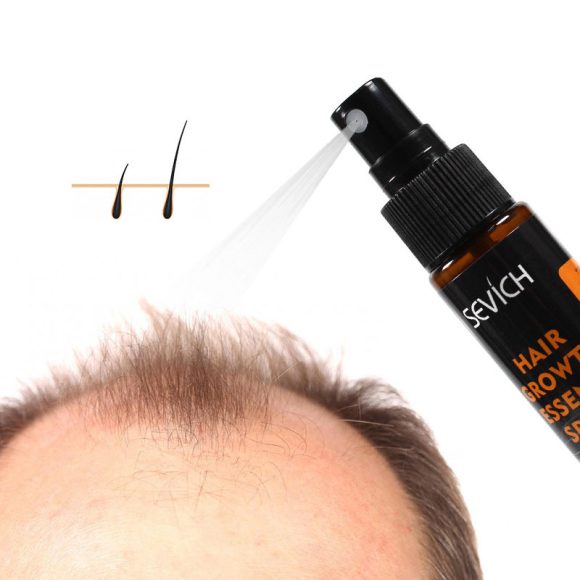 Anti-drop hair lotion tight hair lotion - Image 5