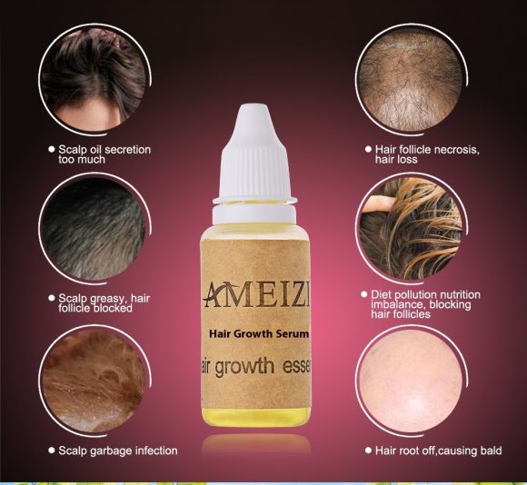 Hair Growth anti Hair Loss Liquid 20ml - Image 3