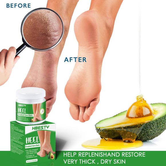 Avocado Heel Cracking Cream - Image 2
