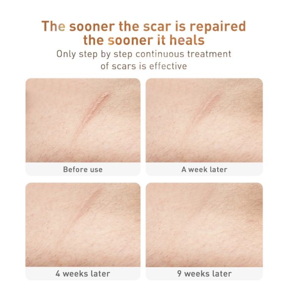Traditional Chinese Medicine Scar Removal Cream Care Cream Skin Care Products - Image 2
