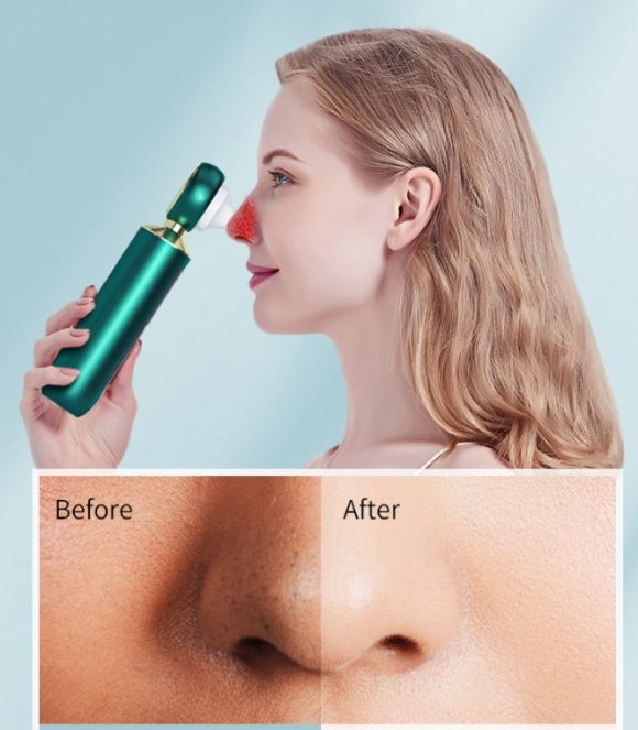 Portable Visual Blackhead Meter Household USB Electric Magnifying Glass Suction Pore Cleaner Blue Light Cleansing To Blackheads - Image 4